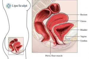 Treatment For A Leaky Bladder 2 How EM Chair treatment London can help Leaky bladder issues. Read more now!